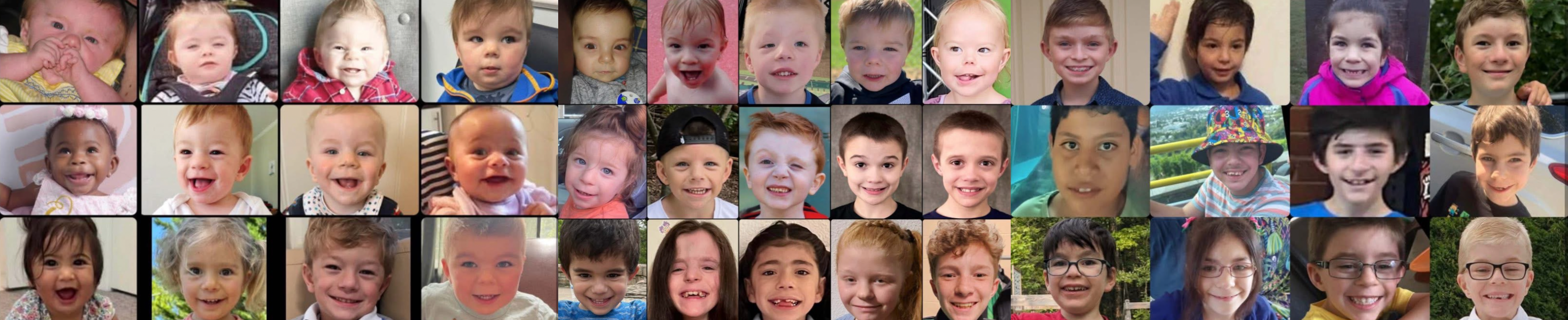 Children with SETD5 Syndrome